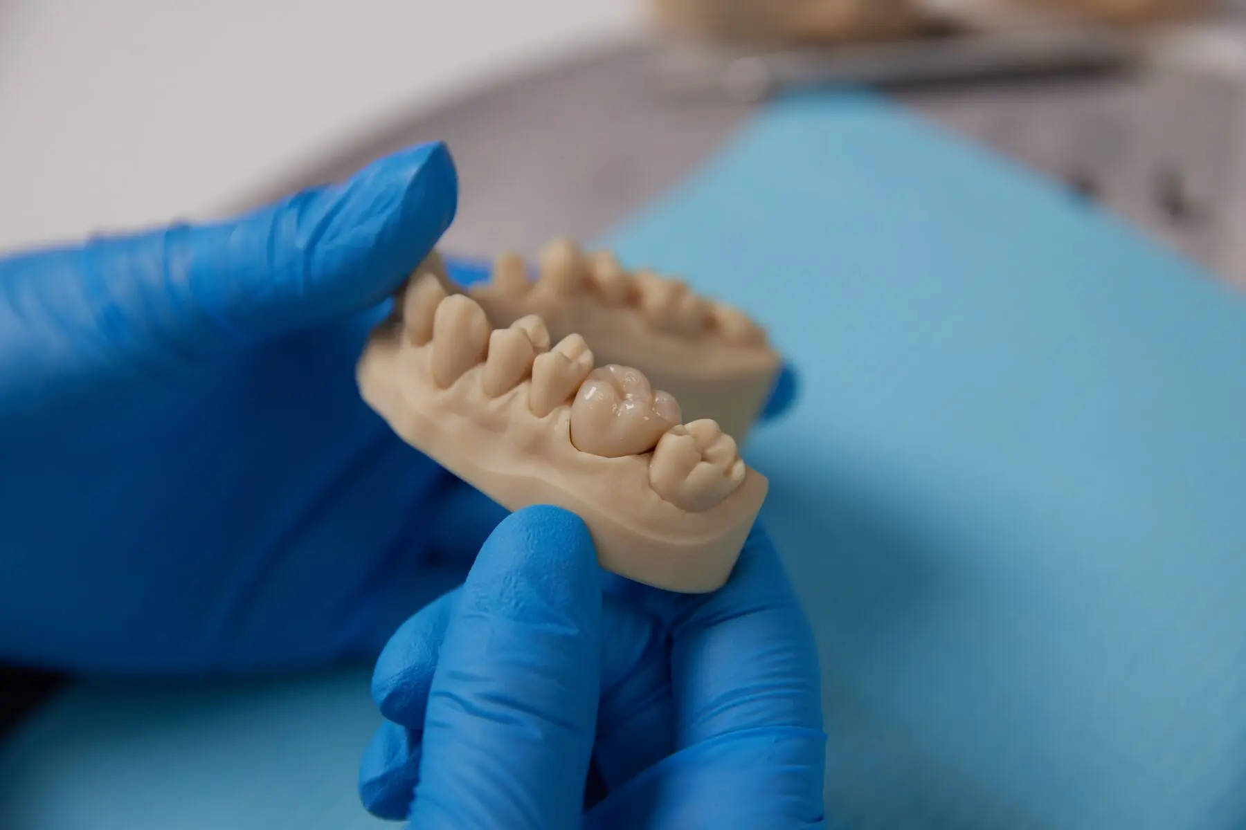 optimized_for_web_jpeg-03142024_dsl_dental_set_485